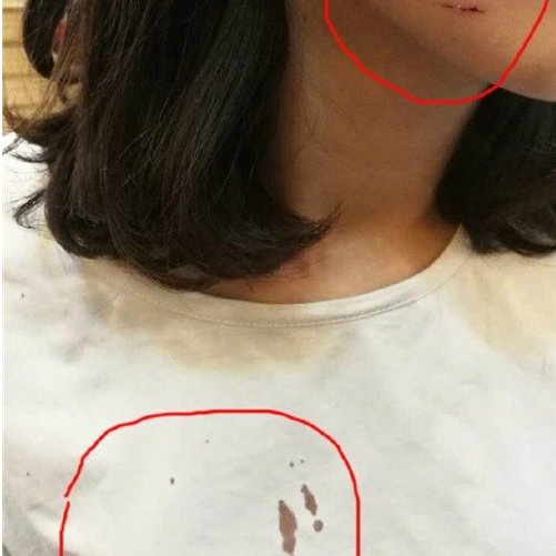 少女被骗KTV遭毒打的原因是什么