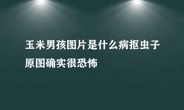 玉米男孩图片是什么病抠虫子原图确实很恐怖