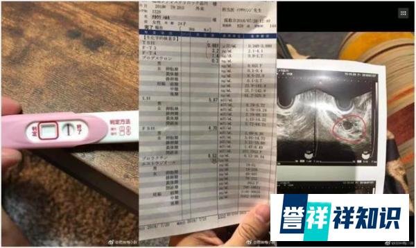 网友曝蒋劲夫已回国，蒋承认家暴女友，好友晒图证女方假孕骗钱