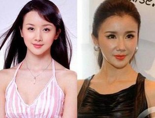 炎亚纶承认鼻子动过,娱乐圈有哪些整容的明星?