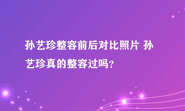 孙艺珍整容前后对比照片 孙艺珍真的整容过吗？