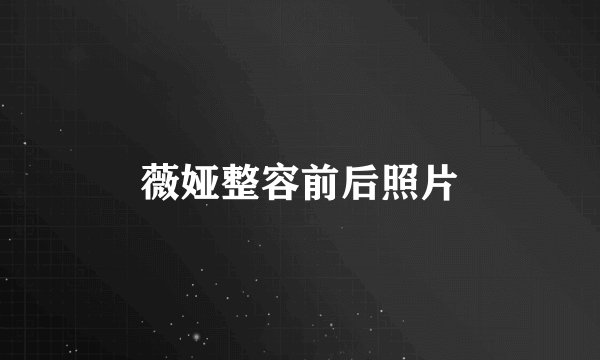 薇娅整容前后照片