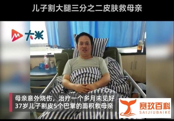 儿子割大腿三分之二皮肤救母和古今割股救人比较