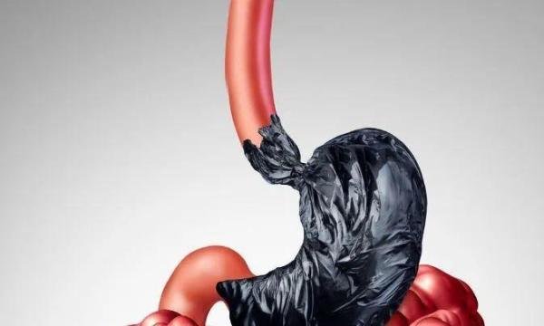 女生喝热水缓解胃痛半年后查出胃癌，喝热水与胃癌有关？