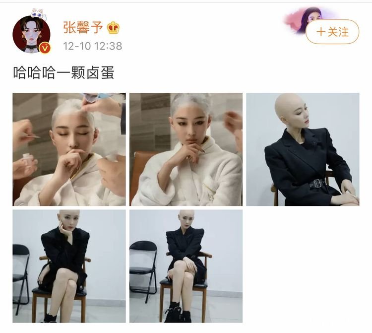 高颜值的张馨予大胆晒“光头”,是不是很任性?