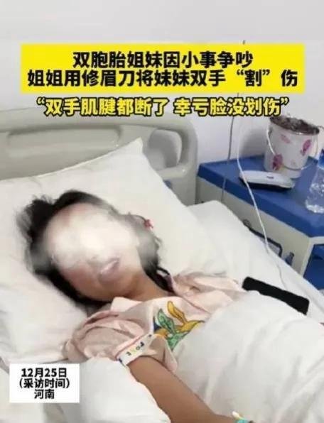 河南一对双胞胎姐妹因小事争吵,姐姐将妹妹双手肌腱割断!