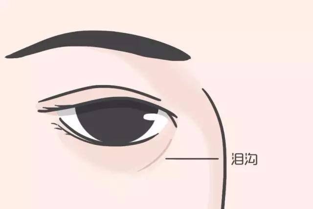 填充眼睛泪沟要多少钱