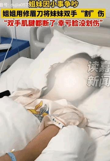 河南一对双胞胎姐妹因小事争吵，姐姐将妹妹双手肌腱割断！