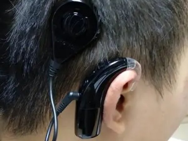 助听器十大名牌