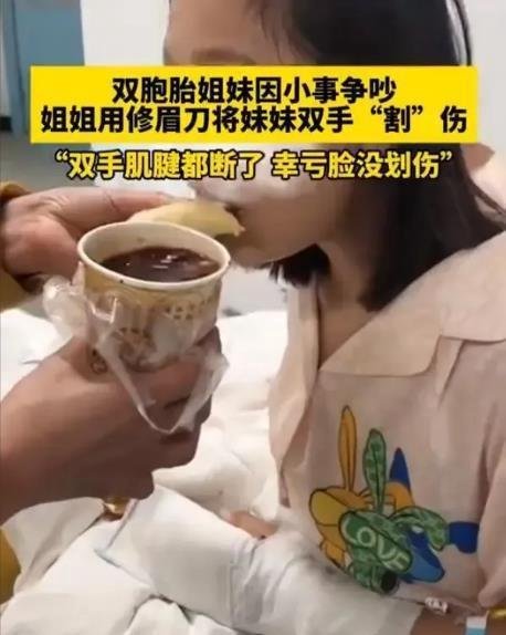 河南一对双胞胎姐妹因小事争吵,姐姐将妹妹双手肌腱割断!