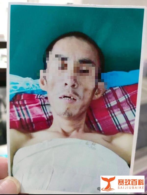 智障男子揣逃犯身份证被捕服刑9年 家人连续申诉八年,“智障男子抢劫案”启动再审